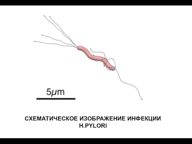 СХЕМАТИЧЕСКОЕ ИЗОБРАЖЕНИЕ ИНФЕКЦИИ H.PYLORI