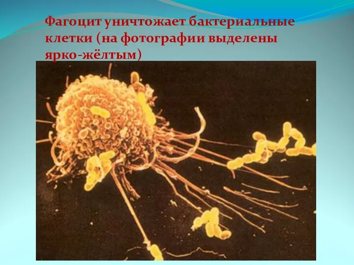 Фагоцит уничтожает бактериальные клетки (на фотографии выделены ярко-жёлтым)