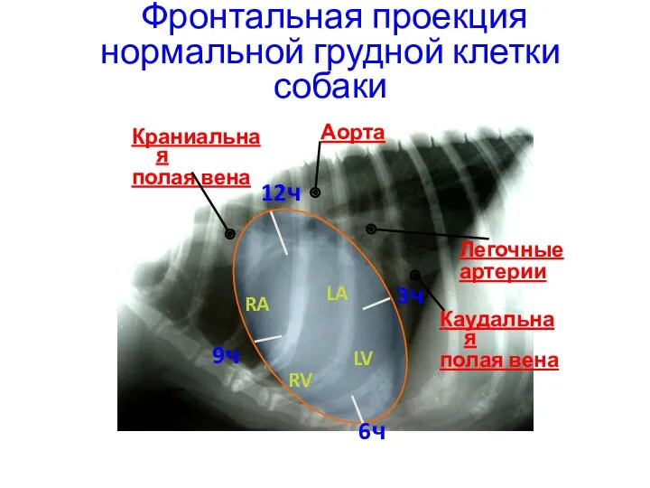 Фронтальная проекция нормальной грудной клетки собаки Аорта Каудальная полая вена