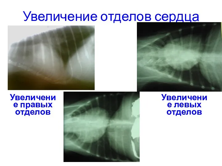 Увеличение отделов сердца Увеличение правых отделов Увеличение левых отделов