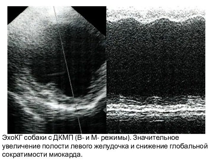 ЭхоКГ собаки с ДКМП (В- и М- режимы). Значительное увеличение