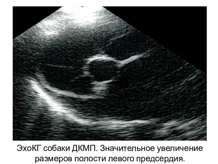 ЭхоКГ собаки ДКМП. Значительное увеличение размеров полости левого предсердия.