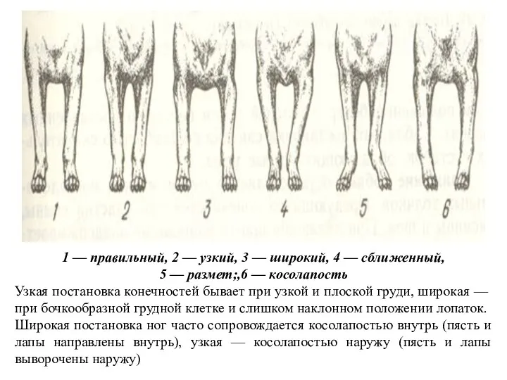 1 — правильный, 2 — узкий, 3 — широкий, 4