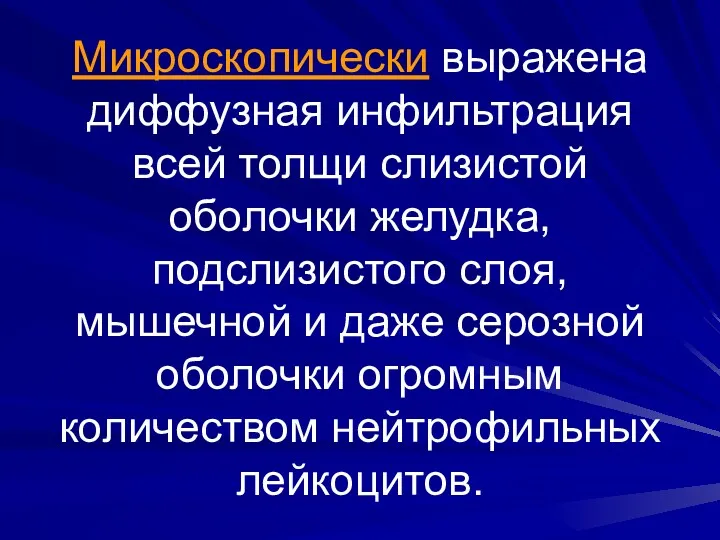 Микроскопически выражена диффузная инфильтрация всей толщи слизистой оболочки желудка, подслизистого