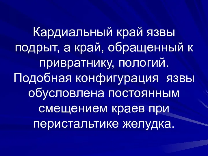 Кардиальный край язвы подрыт, а край, обращенный к привратнику, пологий.