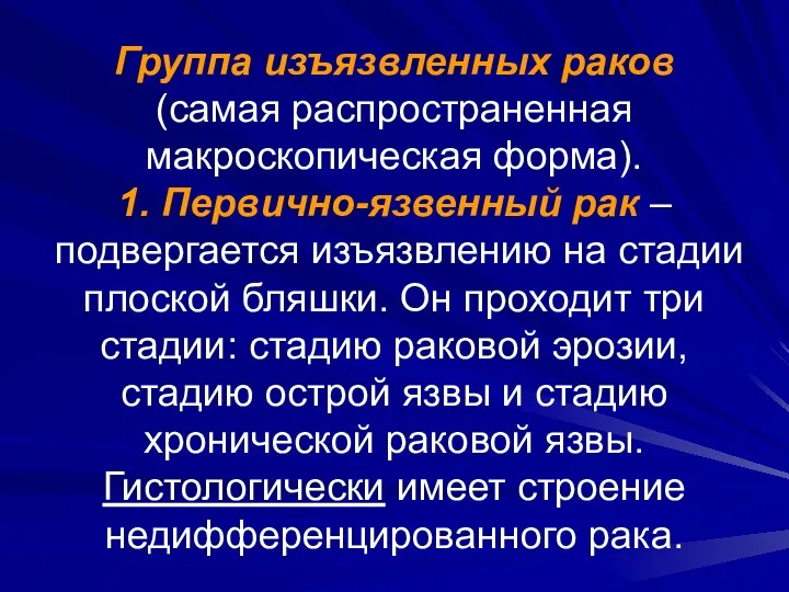 Группа изъязвленных раков (самая распространенная макроскопическая форма). 1. Первично-язвенный рак