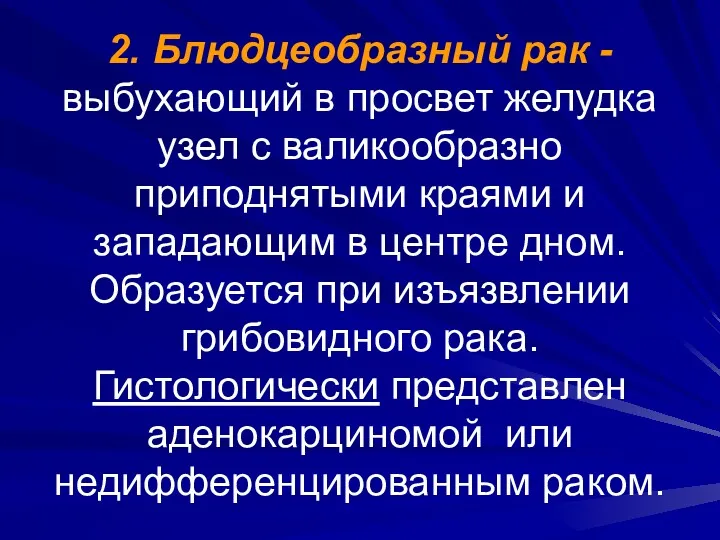 2. Блюдцеобразный рак - выбухающий в просвет желудка узел с