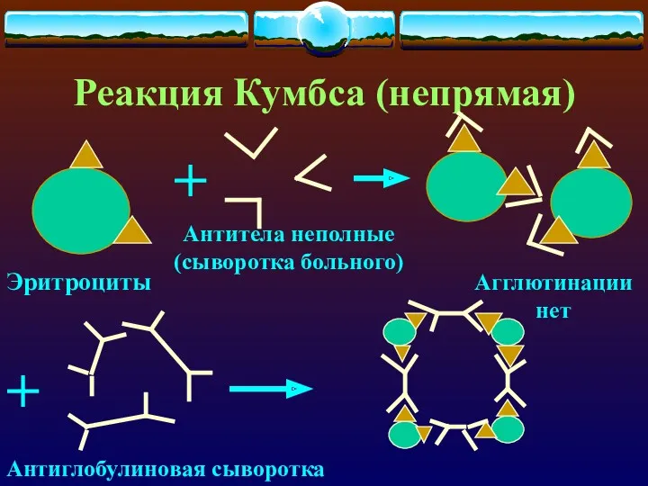 Реакция Кумбса (непрямая) + Эритроциты Антитела неполные (сыворотка больного) Агглютинации нет + Антиглобулиновая сыворотка