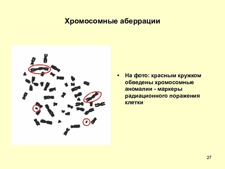 Хромосомные аберрации На фото: красным кружком обведены хромосомные аномалии - маркеры радиационного поражения клетки