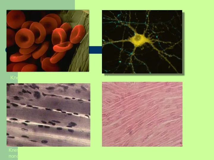 Клетки крови (эритроциты) Нервная клетка Клетки скелетной поперечно-полосатой мышечной ткани Клетки гладкой мышечной ткани