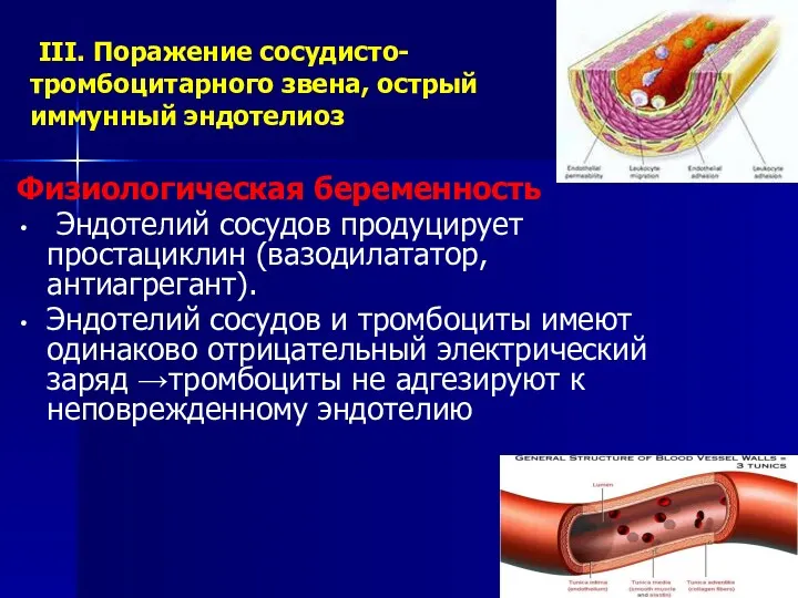 III. Поражение сосудисто-тромбоцитарного звена, острый иммунный эндотелиоз Физиологическая беременность Эндотелий