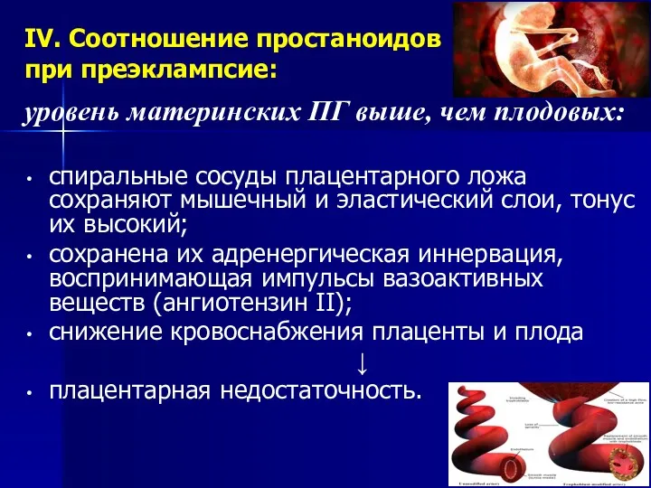 IV. Соотношение простаноидов при преэклампсие: уровень материнских ПГ выше, чем