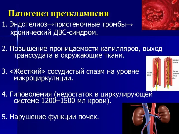 Патогенез преэклампсии 1. Эндотелиоз→пристеночные тромбы→ хронический ДВС-синдром. 2. Повышение проницаемости