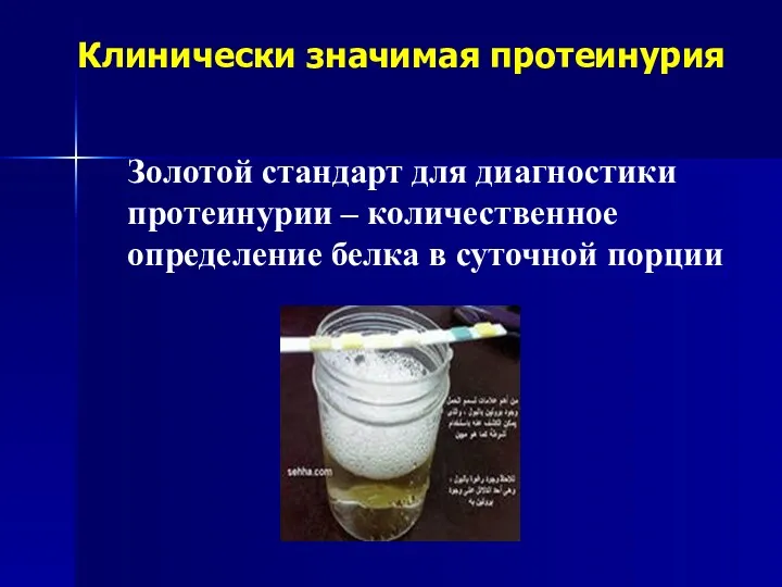 Клинически значимая протеинурия Золотой стандарт для диагностики протеинурии – количественное определение белка в суточной порции