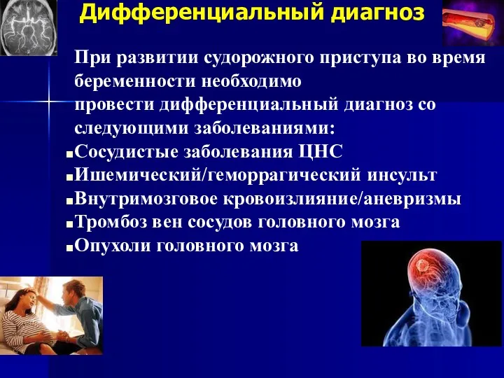 Дифференциальный диагноз При развитии судорожного приступа во время беременности необходимо