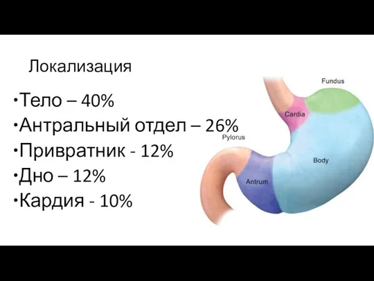 Локализация Тело – 40% Антральный отдел – 26% Привратник - 12% Дно –