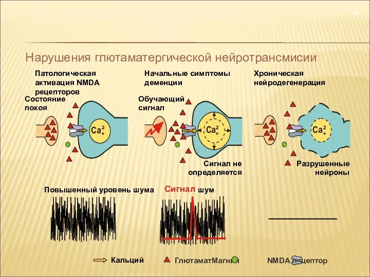 2+ Ca Сигнал не определяется 2+ Ca Патологическая активация NMDA