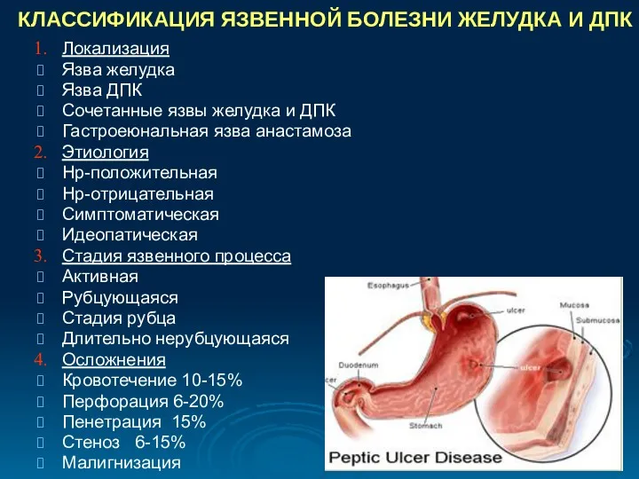 КЛАССИФИКАЦИЯ ЯЗВЕННОЙ БОЛЕЗНИ ЖЕЛУДКА И ДПК Локализация Язва желудка Язва