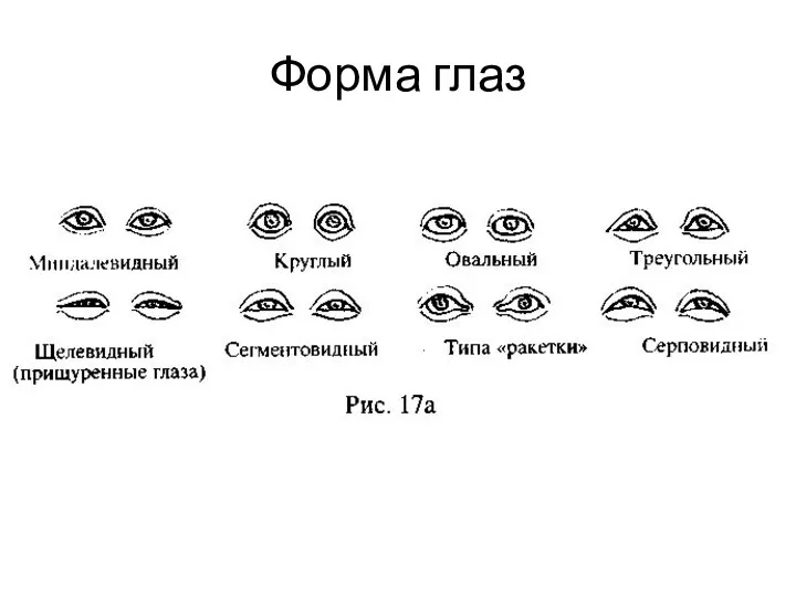 Форма глаз