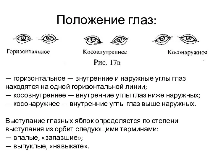 Положение глаз: — горизонтальное — внутренние и наружные углы глаз