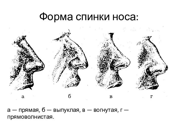 Форма спинки носа: а — прямая, б — выпуклая, в — вогнутая, г —прямоволнистая.