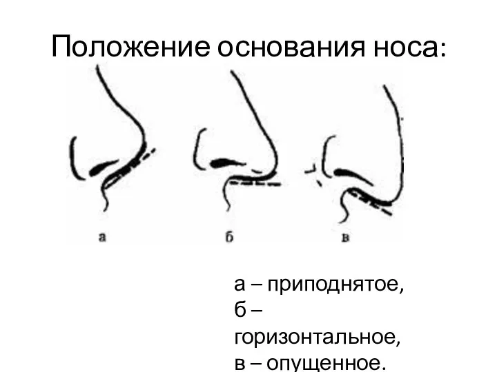 Положение основания носа: а – приподнятое, б – горизонтальное, в – опущенное.