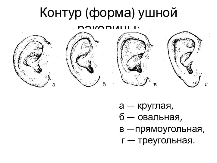 Контур (форма) ушной раковины: а — круглая, б — овальная, в —прямоугольная, г — треугольная.