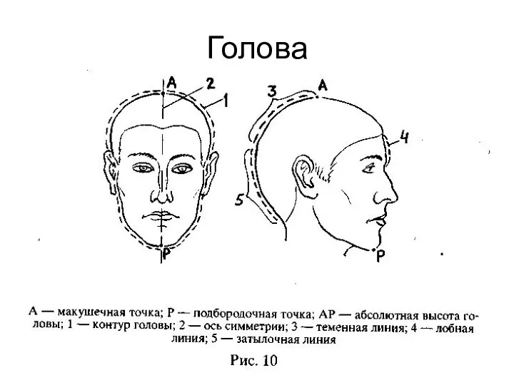 Голова