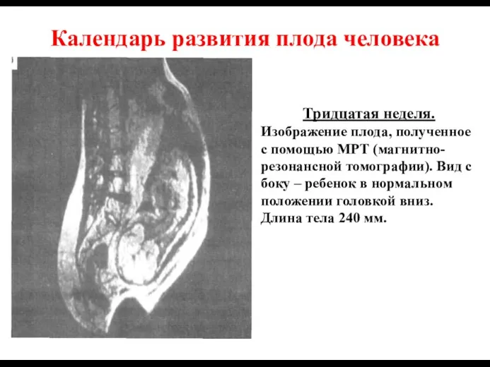 Календарь развития плода человека Тридцатая неделя. Изображение плода, полученное с