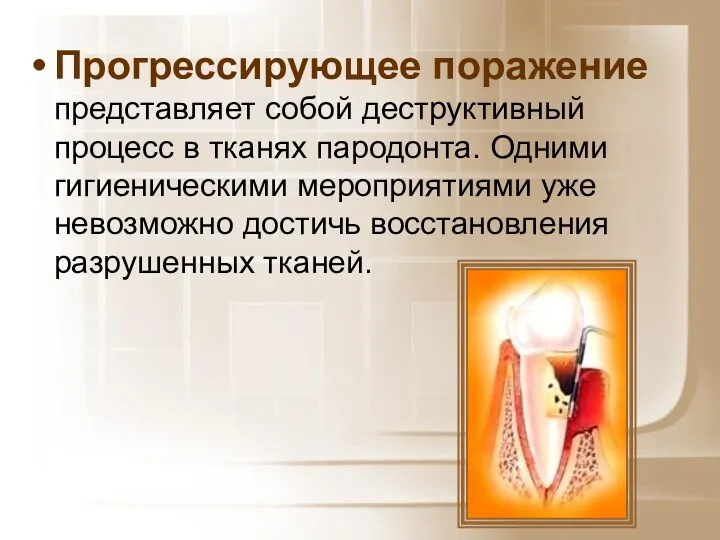 Прогрессирующее поражение представляет собой деструктивный процесс в тканях пародонта. Одними