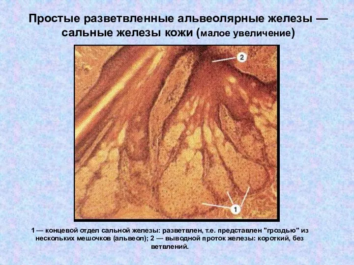Простые разветвленные альвеолярные железы — сальные железы кожи (малое увеличение) 1 — концевой