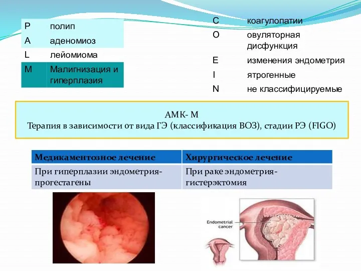 АМК- М Терапия в зависимости от вида ГЭ (классификация ВОЗ), стадии РЭ (FIGO)