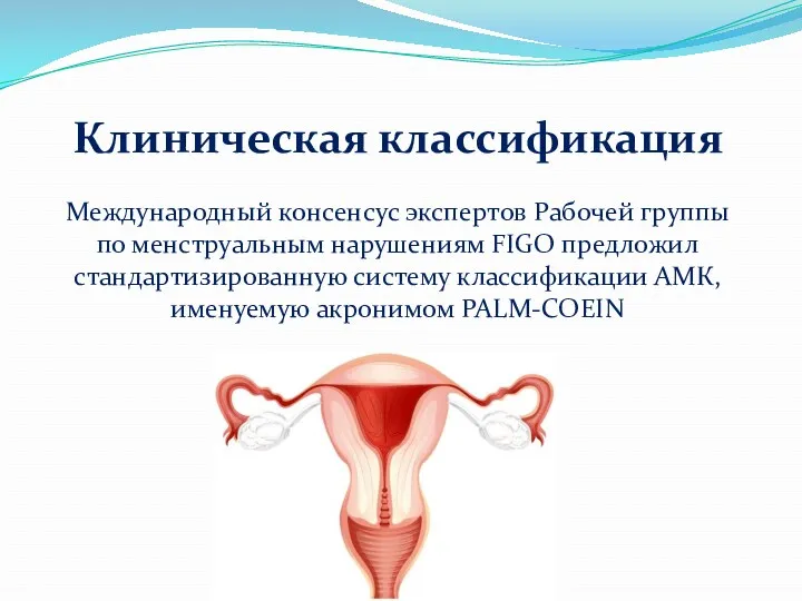 Клиническая классификация Международный консенсус экспертов Рабочей группы по менструальным нарушениям