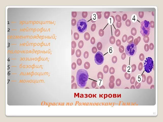 Мазок крови Окраска по Романовскому–Гимзе. 1 — эритроциты; 2 —