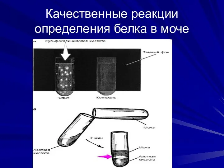 Качественные реакции определения белка в моче