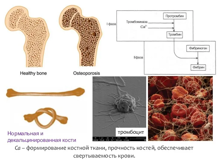 Ca – формирование костной ткани, прочность костей, обеспечивает свертываемость крови. тромбоцит Нормальная и декальцинированная кости