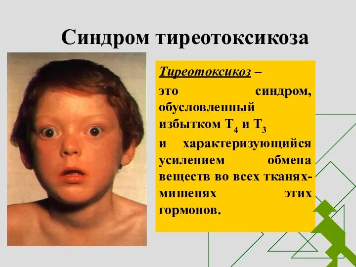 Синдром тиреотоксикоза Тиреотоксикоз – это синдром, обусловленный избытком Т4 и