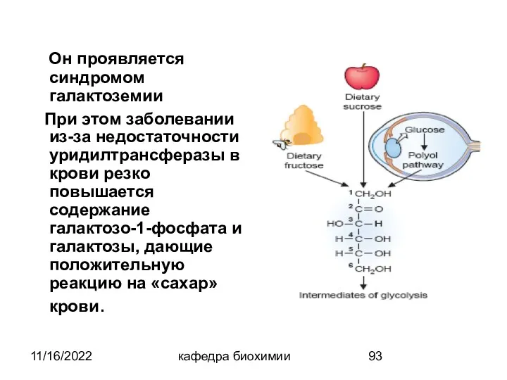 11/16/2022 кафедра биохимии Он проявляется синдромом галактоземии При этом заболевании