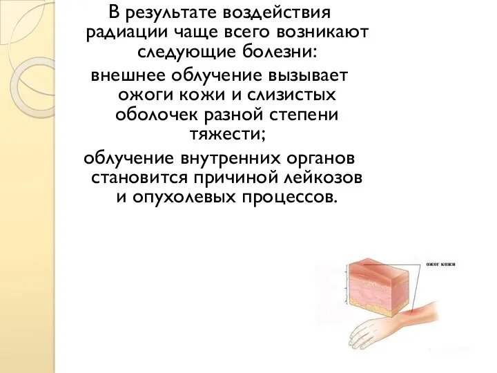 В результате воздействия радиации чаще всего возникают следующие болезни: внешнее