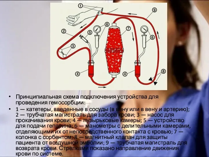 Принципиальная схема подключения устройства для проведения гемосорбции: 1 — катетеры,