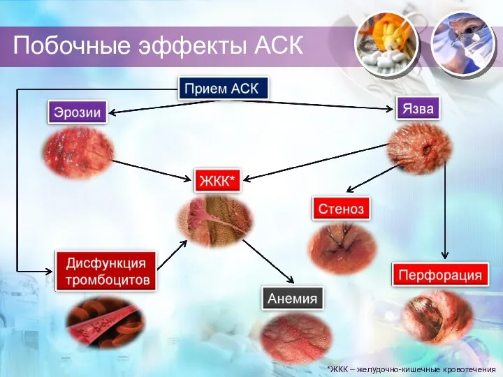 Побочные эффекты АСК *ЖКК – желудочно-кишечные кровотечения