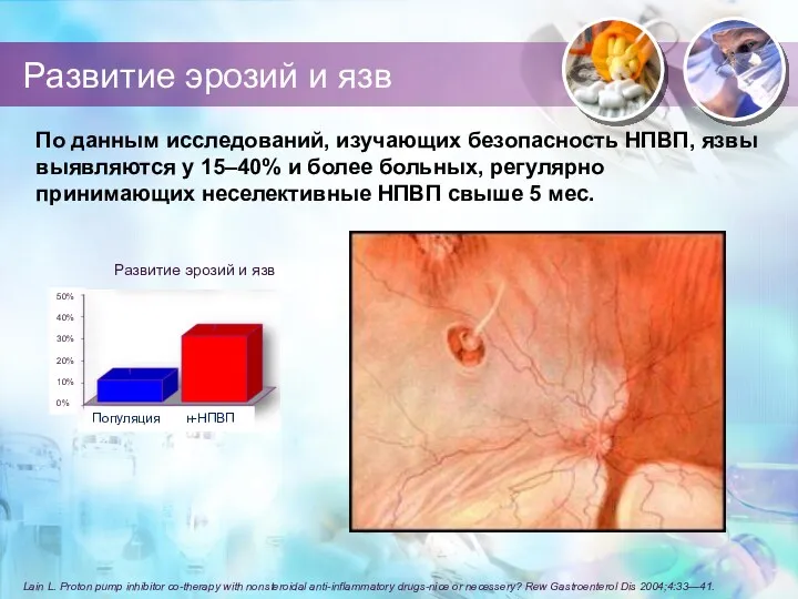 Развитие эрозий и язв Lain L. Proton pump inhibitor co-therapy with nonsteroidal anti-inflammatory