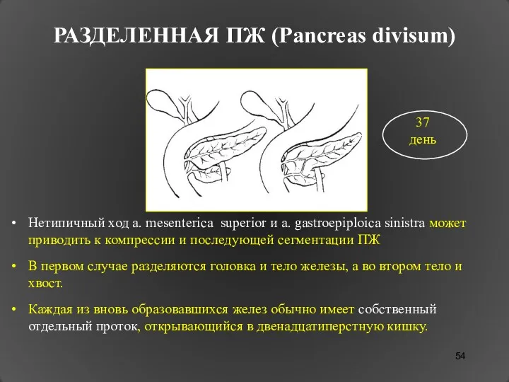 РАЗДЕЛЕННАЯ ПЖ (Pancreas divisum) Нетипичный ход a. mesenterica superior и a. gastroepiploica sinistra