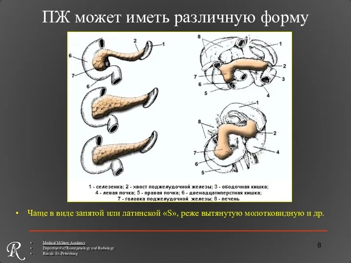 ПЖ может иметь различную форму Чаще в виде запятой или