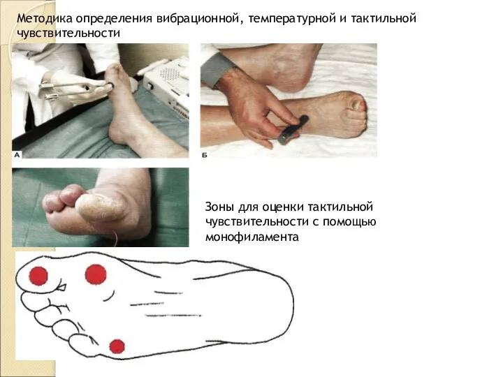 Зоны для оценки тактильной чувствительности с помощью монофиламента Методика определения вибрационной, температурной и тактильной чувствительности