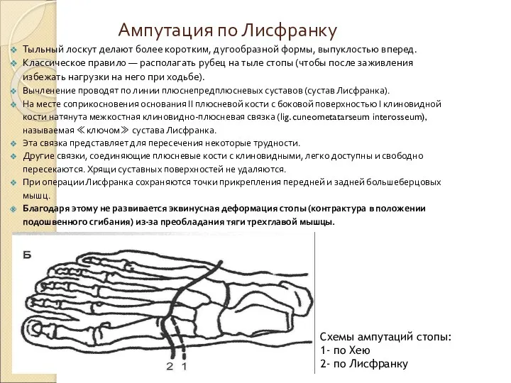 Ампутация по Лисфранку Тыльный лоскут делают более коротким, дугообразной формы, выпуклостью вперед. Классическое