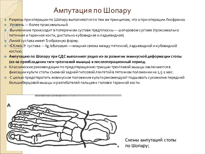 Ампутация по Шопару Разрезы при операции по Шопару выполняются по тем же принципам,
