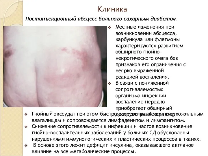 Клиника Гнойный экссудат при этом быстро распространяется по сухожильным влагалищам и сопровождается лимфаденитом