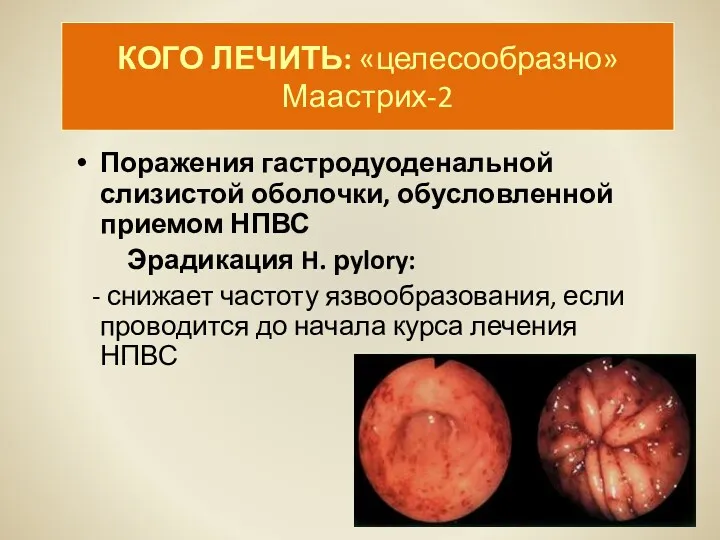 КОГО ЛЕЧИТЬ: «целесообразно» Маастрих-2 Поражения гастродуоденальной слизистой оболочки, обусловленной приемом