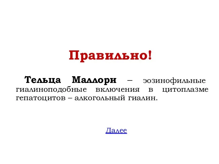 Правильно! Тельца Маллори – эозинофильные гиалиноподобные включения в цитоплазме гепатоцитов – алкогольный гиалин. Далее